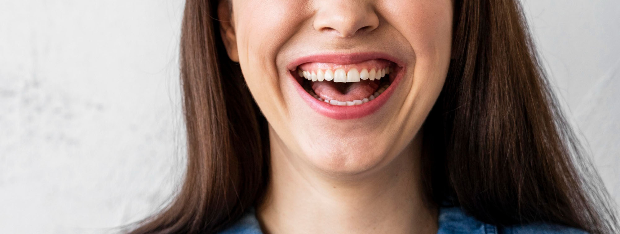 Lee más sobre el artículo Sonrisa gingival: ¿Por qué se produce y qué tratamientos existen?